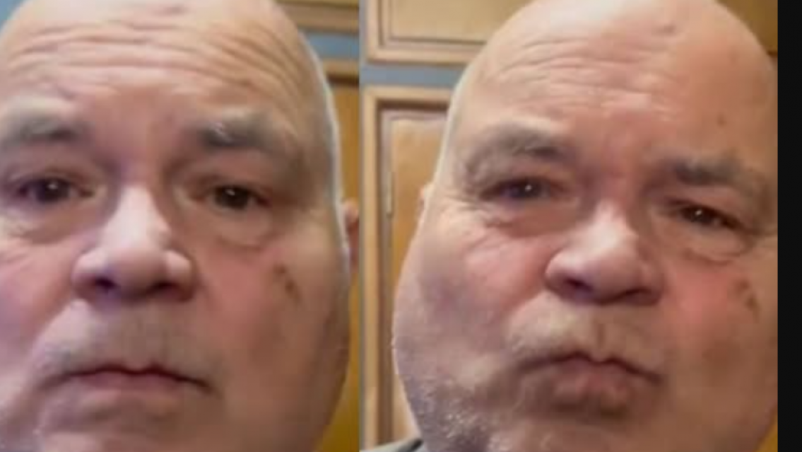 Compró carillas para los dientes en Temu y así le quedó la cara