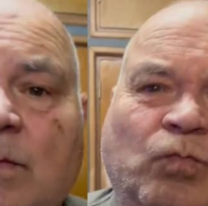 Compr&oacute; carillas para los dientes en Temu y as&iacute; le qued&oacute; la cara