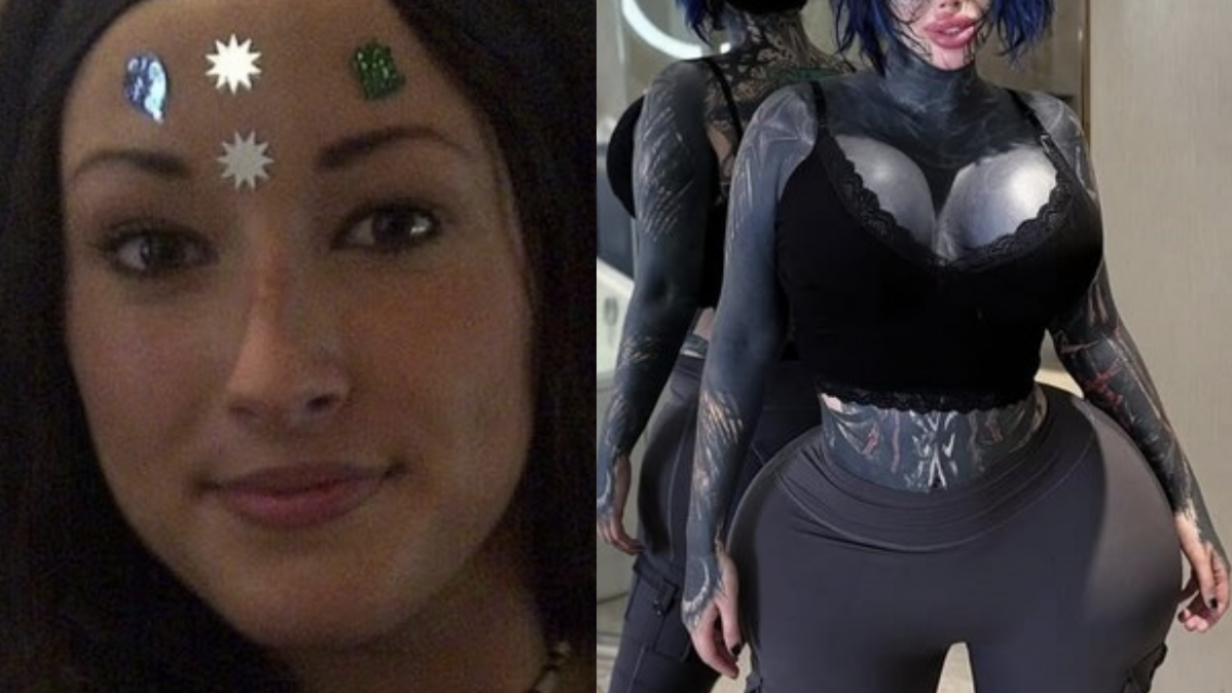 Antes y despu�s de la influencer "adicta a las cirug�as que muri� a los 33 a�os