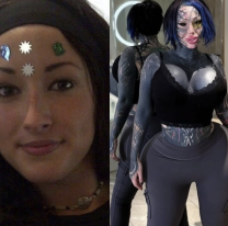 Antes y despu&eacute;s de la influencer "adicta a las cirug&iacute;as que muri&oacute; a los 33 a&ntilde;os