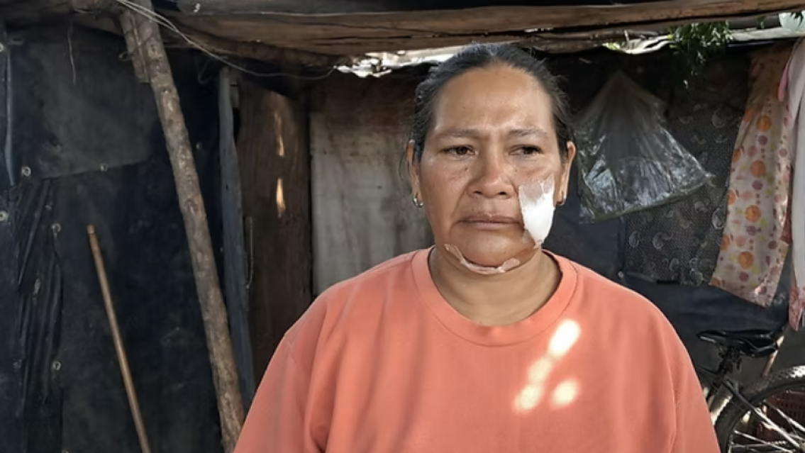 "No te voy a pagar": jujeña fue a cobrar una deuda y la atacaron con perros