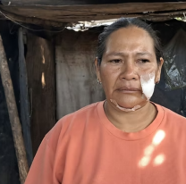 "No te voy a pagar": juje&ntilde;a fue a cobrar una deuda y la atacaron con perros