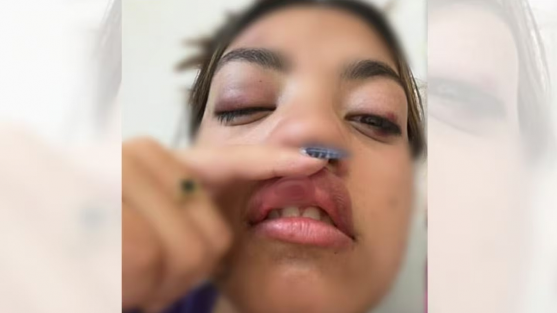 Entre mujeres tambi�n pasa: chicas atacaron a una joven a la salida del boliche