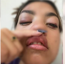 Entre mujeres también pasa: chicas atacaron a una joven a la salida del boliche