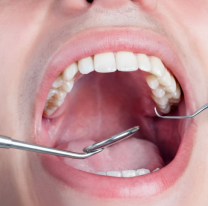 Alerta: la se&ntilde;al silenciosa que puede indicar s&iacute;filis