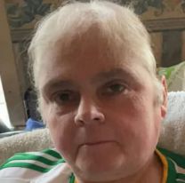 Ten&iacute;a una mancha en el dedo y pensaron que era la tinta del diario: le amputaron el brazo y muri&oacute;