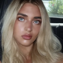 Lo que la plata no puede comprar: Marta Fort atropell&oacute; a una se&ntilde;ora y la est&aacute; pasando mal