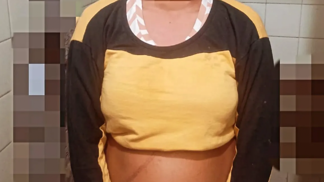 Brutal asalto en Gorriti: la golpeó en la calle y le robó el celular