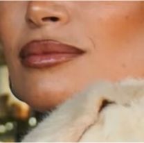 Reconocida influencer volc&oacute; en los m&eacute;danos: lucha por su vida