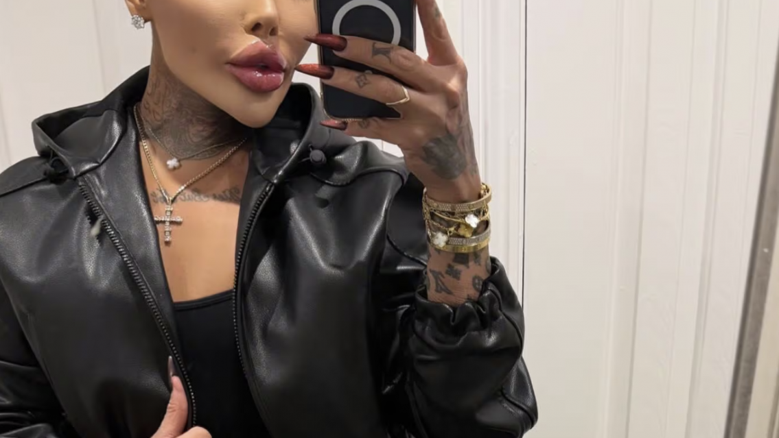 Se hizo decenas de cirugías y falleció: a quién se quería parecer