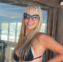 "Ahí abajo": Graciela Alfano habló del tratamiento que se hizo para rejuvenecer