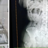 Camellos bolivianas fueron detenidas en ruta norte&ntilde;a: 198 c&aacute;psulas en la panza 