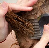 Pediculosis: el drama de todos los años con el inicio de clases