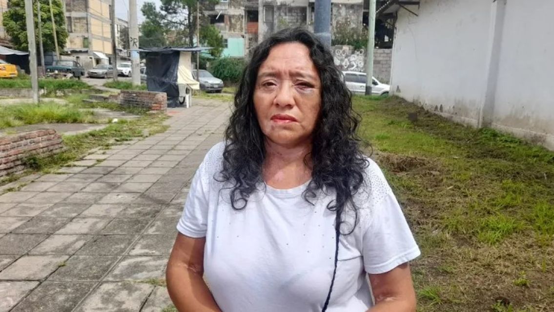 Jujeña quiso ayudar en un choque y un borracho la noqueó: "Veo borroso..."