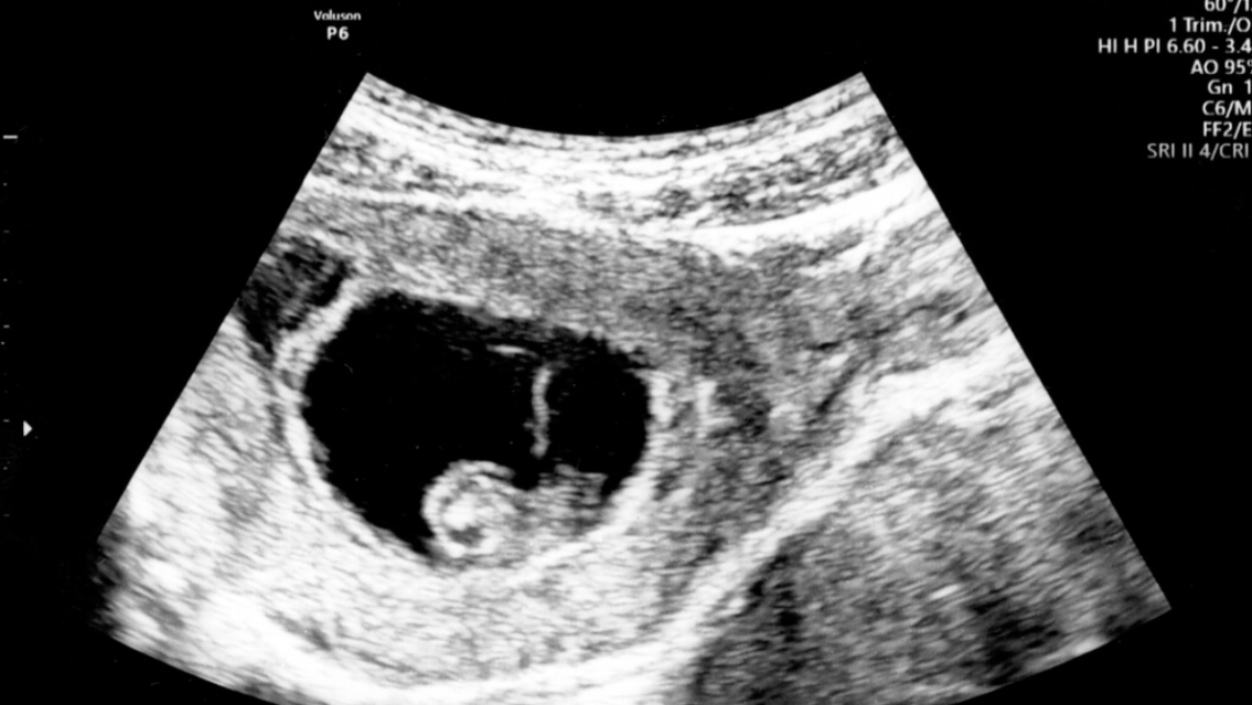 Tras dos matrimonios escandalosos, la modelo y conductora más querida será mamá de nuevo