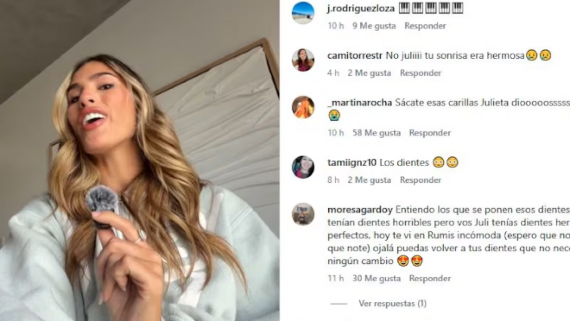 Juli Poggio mostró los mensajes que le llegaron por su retoque estético