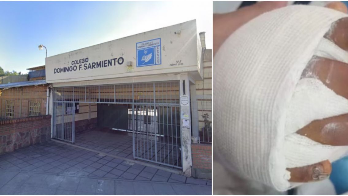 "Tiene el 95% de la mano destruida": la dura denuncia de la madre del alumno herido en una escuela de Jujuy