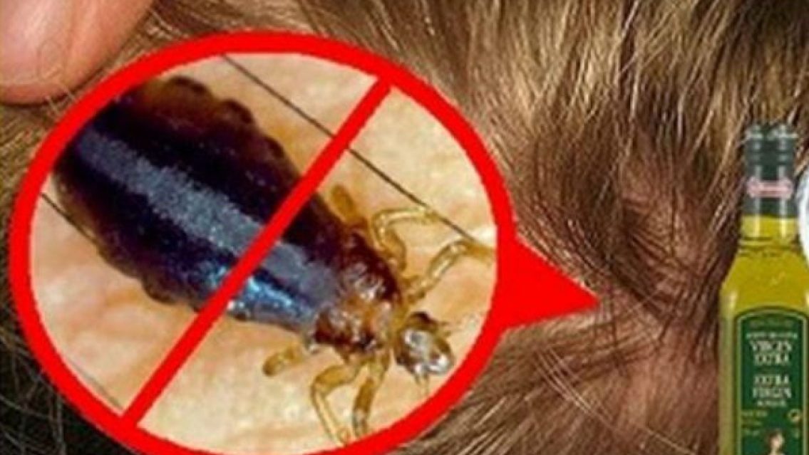 8 remedios caseros para eliminar los piojos de una vez por todas