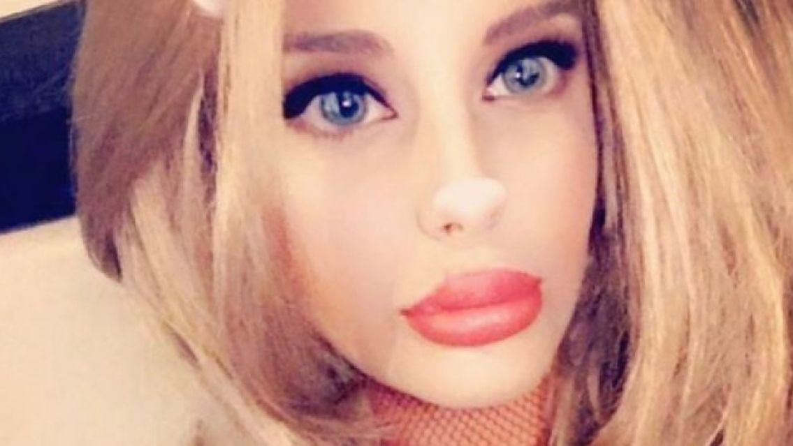 [HAY FOTOS] Filtran fotos de Charlotte Cannigia antes de todas las cirug�as