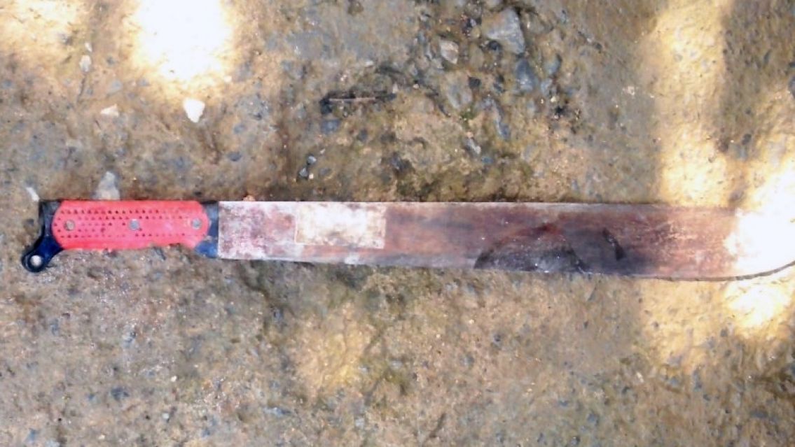 Sangriento ataque en Jujuy: Lo agarraron a machetazos y le partieron la cabeza