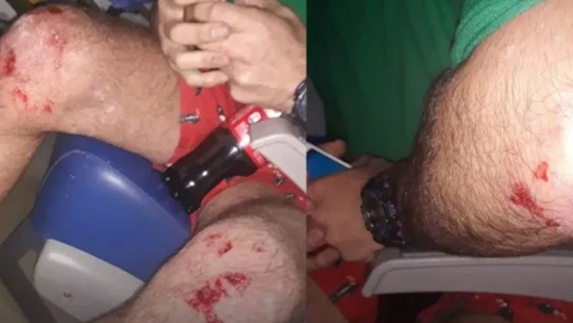 Salvaje ataque homof�bico: persigui� y golpe� a latigazos a una pareja gay