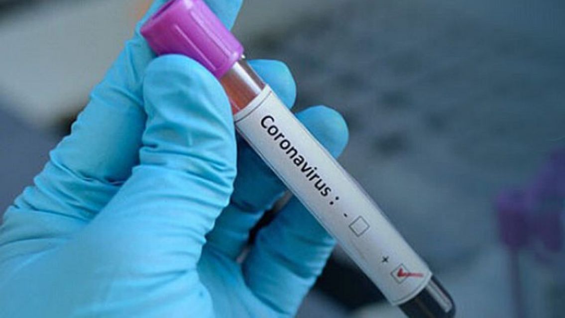 Seg�n Naci�n, hoy se registraron 117 casos de coronavirus en Jujuy