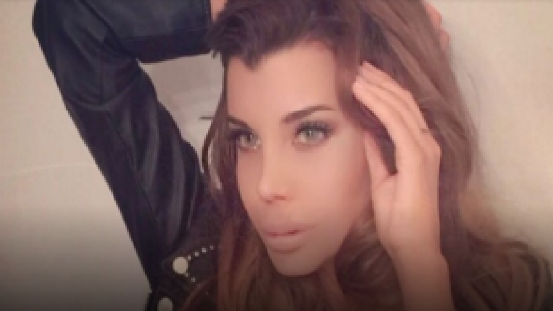 Charlotte se oper� la cola y le qued� gigante: �Parece mu�eca inflable�