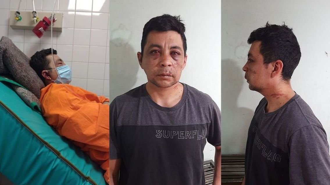 Enfermero se curó de coronavirus: los vecinos lo reventaron a golpes y le quemaron la casa