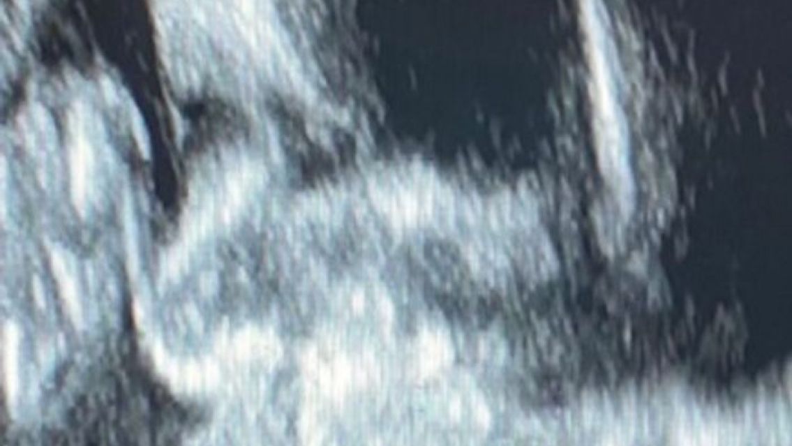 Pampita mostró por primera vez la cara de su hija. Difundió en redes la foto de su ecografía