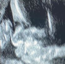 Pampita mostr&oacute; por primera vez la cara de su hija. Difundi&oacute; en redes la foto de su ecograf&iacute;a 