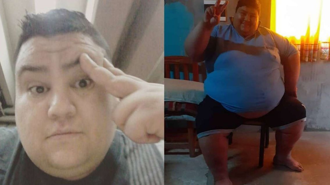 El dramático presente de Luisito: está en 300 kilos y se le reventaron las várices