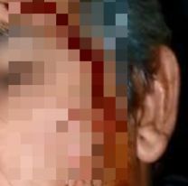 En el d&iacute;a del trabajador, taxista termin&oacute; ba&ntilde;ado de sangre y muy triste