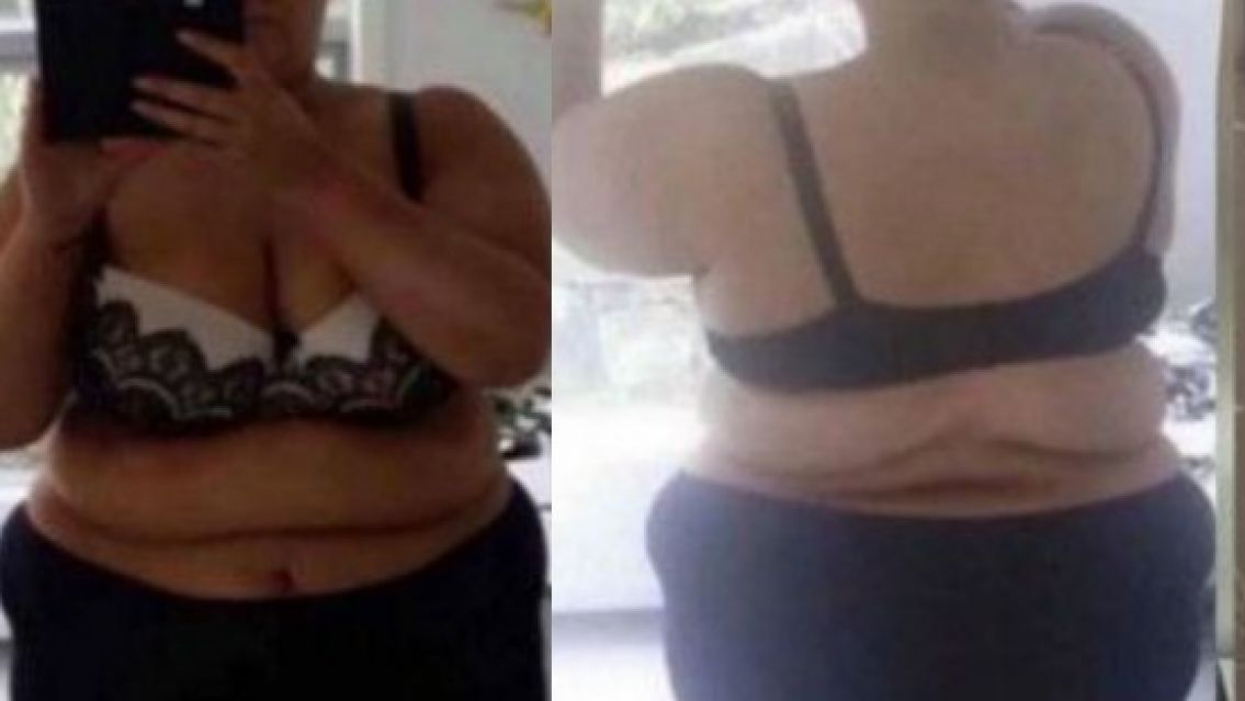 La increíble transformación de la mujer que perdió 88 kilos en 20 meses