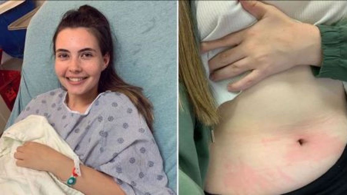 Se lastima con sus propias l�grimas: la incre�ble alergia de esta chica 