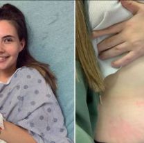 Se lastima con sus propias l&aacute;grimas: la incre&iacute;ble alergia de esta chica 