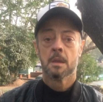 Bajó muchísimo de peso para estar mejor de salud y ahora piden dadores de sangre para Cabito