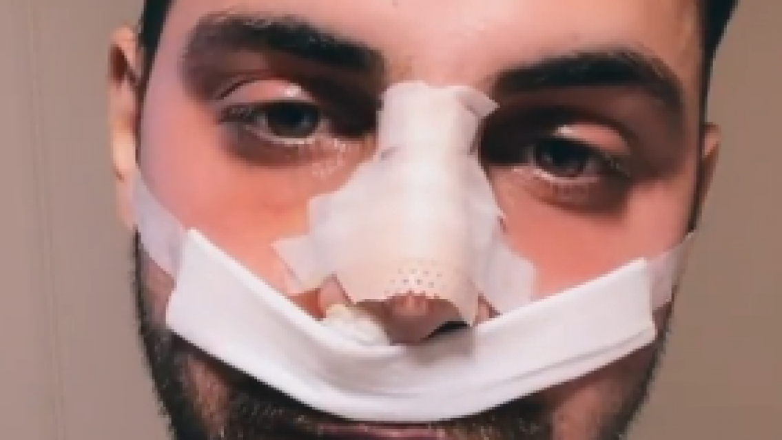 El terrible accidente que sufrió el influencer Grego Rossello