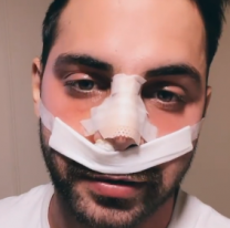 El terrible accidente que sufri&oacute; el influencer Grego Rossello