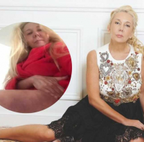 Cont&oacute; toda la verdad: Mariana Nannis mostr&oacute; los moretones que le dej&oacute; Claudio Paul Caniggia