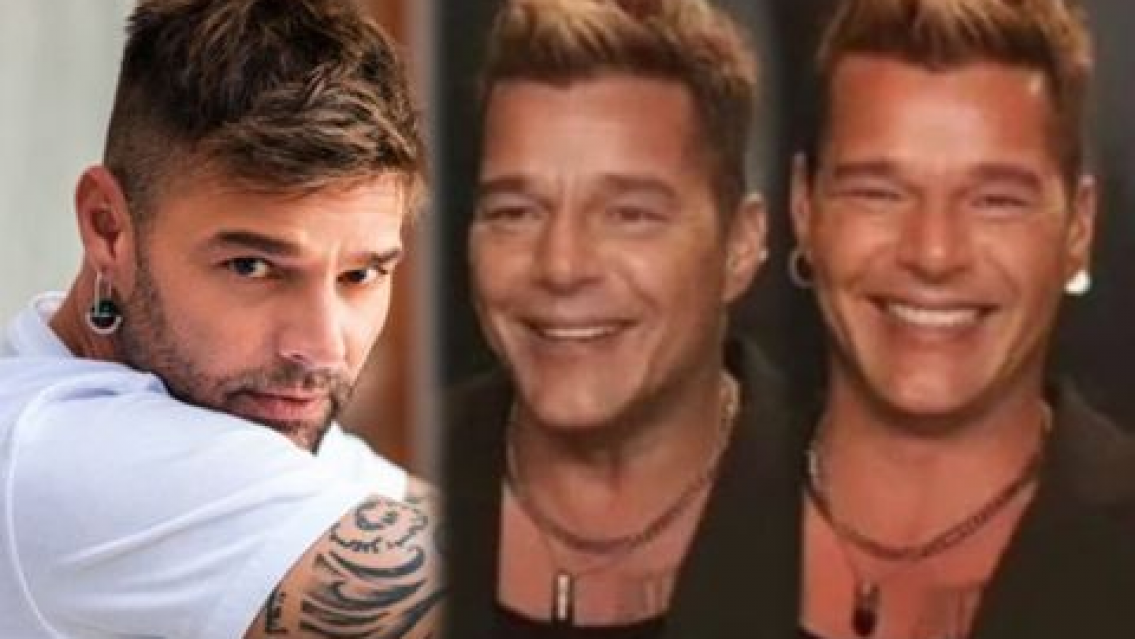 Ricky Martin rompió el silencio para hablar de su supuesta cirugía estética: "Me hice..."