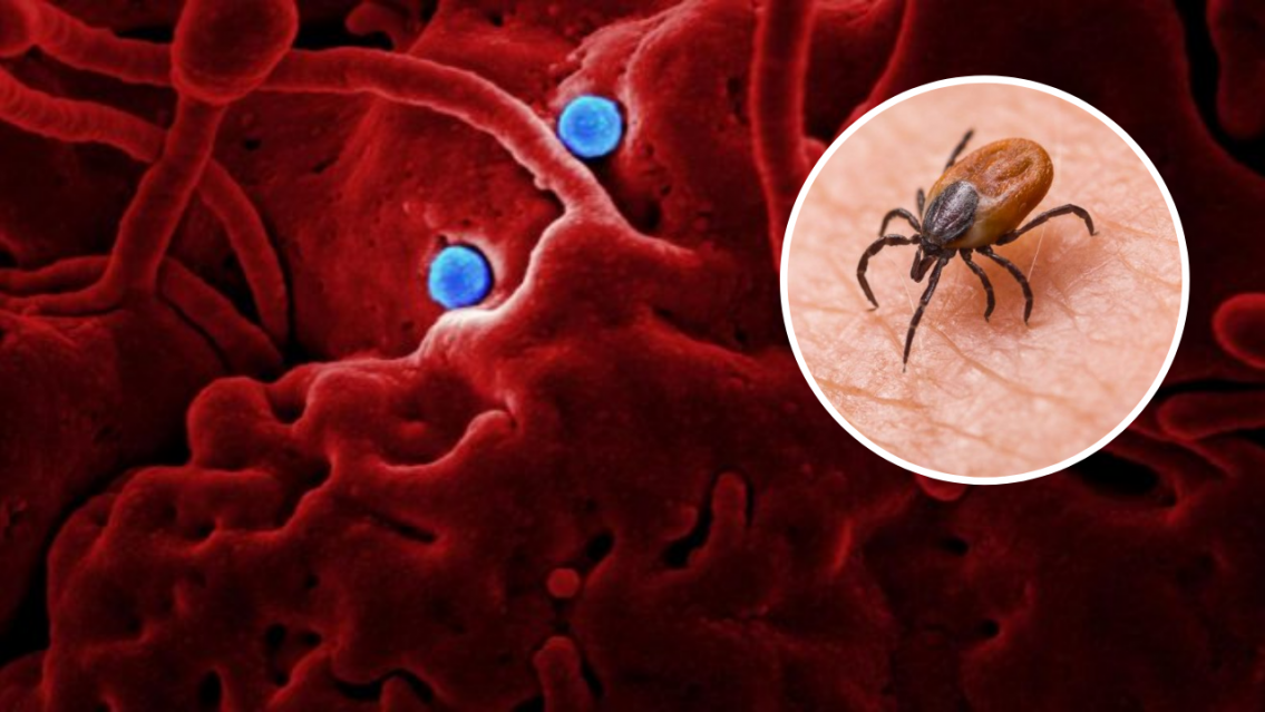 Yezo: c�mo es el nuevo virus que puede contagiarse a�n al aire libre