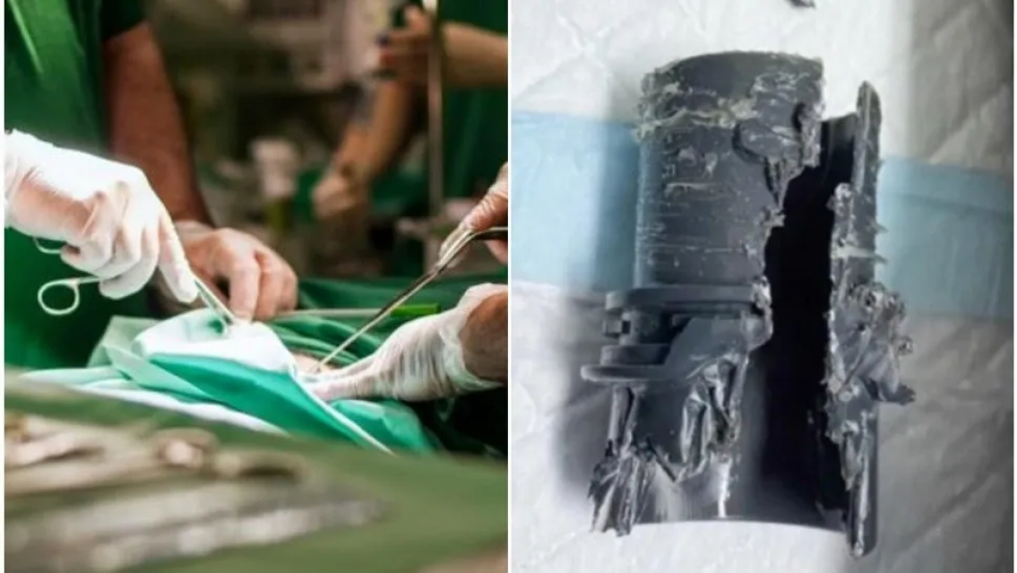 Se agrand� "el miembro", quiso comprobar el tama�o y se le trab�. Acab� en el hospital