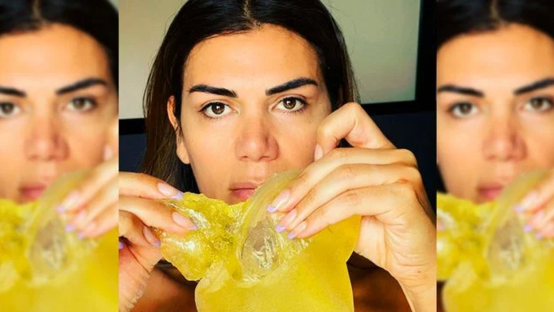 El terrible accidente de Flor de la V: se le explot� una de las "lolas"