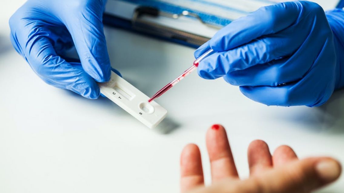 Prohibieron un test r�pido de covid en Argentina por "ser falsificado"