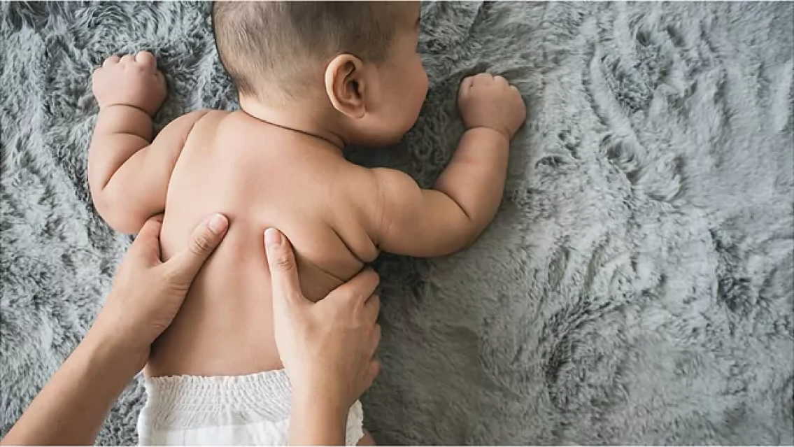 Conmoci�n por beb� que naci� con una "cola" humana. A qu� se debe y cu�les son los riesgos