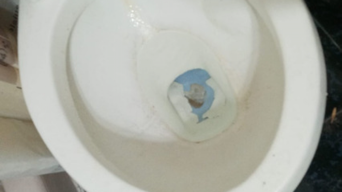 Se sentó en el inodoro, una cobra le mordió "el amigo" y se lo "mató".