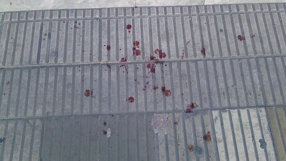 En uno de los barrios más peligrosos de Jujuy, le enterraron un cuchillo en el pecho a un changuito