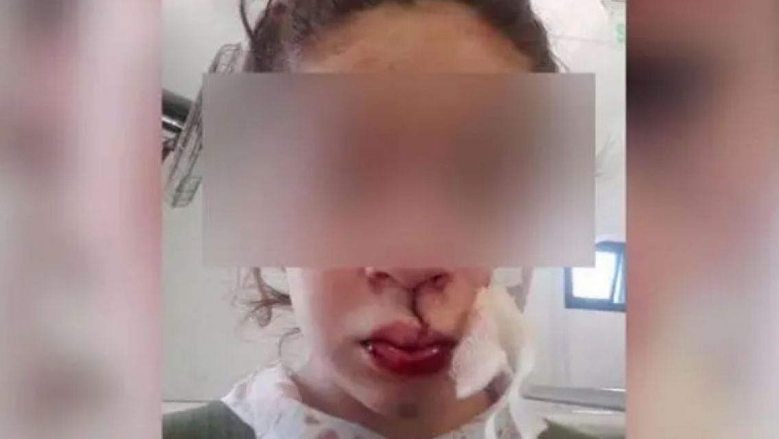 Ataque salvaje: la polic�a la par� y le pegaron hasta sacarle los dientes