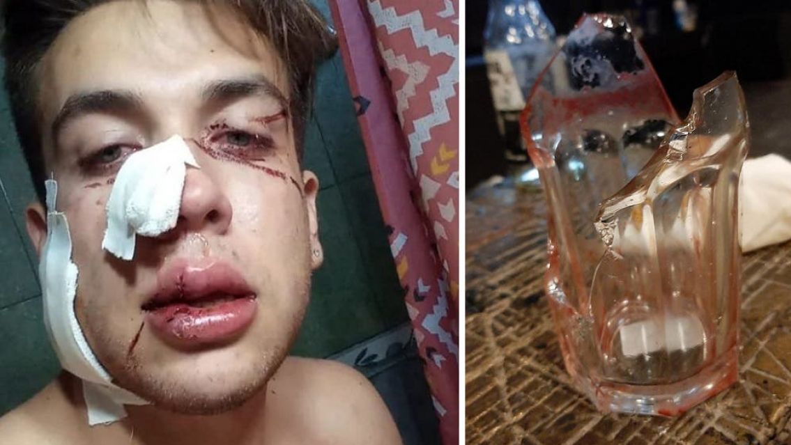 Violento ataque a un joven en un boliche norte�o, le estallaron un vidrio en la cara