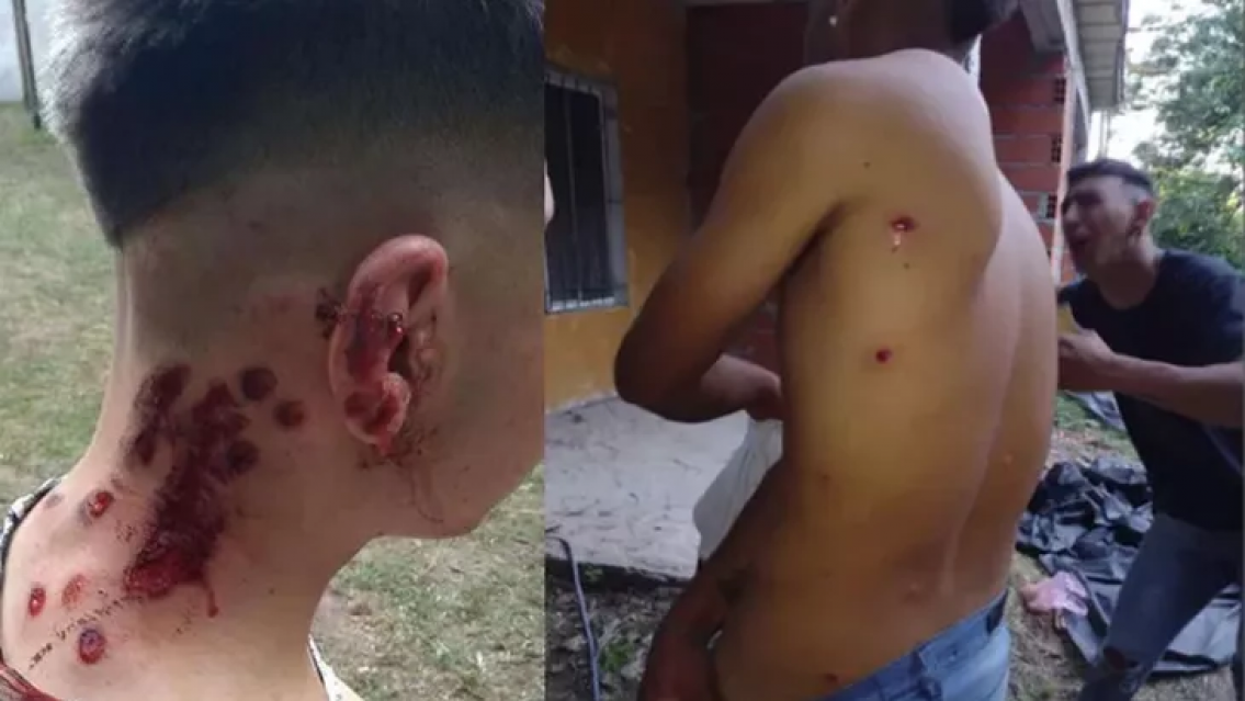 Investigan a 25 polic�as por dispararles a 11 j�venes tras una fiesta. �Hasta cu�ndo?